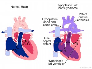 chd plus other issues ea-tef & tof-oa